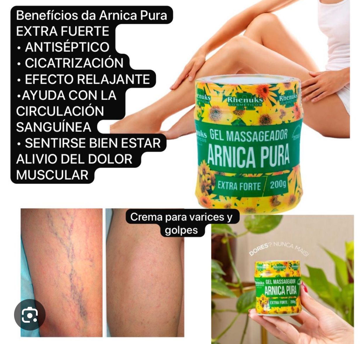 CREMA PARA VARICES ARNICA