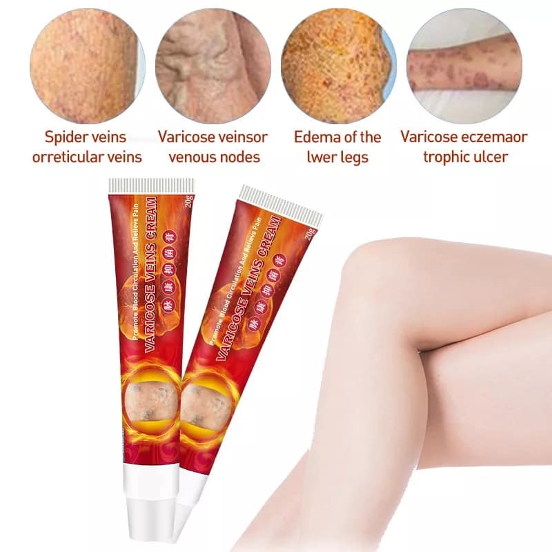 Varicose Veins Cream Pomada